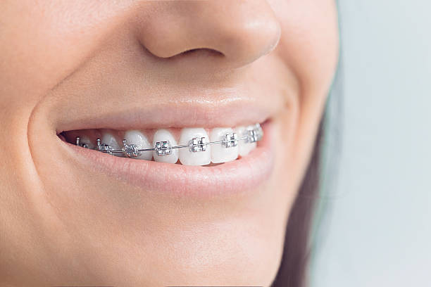 Best Emergency Dental Care  in Parker City, IN